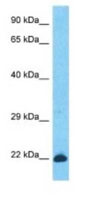 Western Blot: KRTAP26-1 Antibody [NBP3-09226]