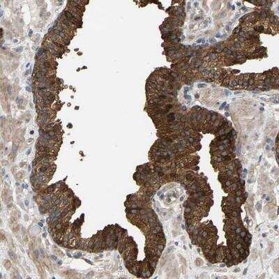 Immunohistochemistry: KRTAP27-1 Antibody [NBP1-91071]