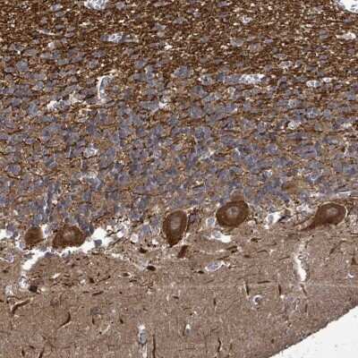 Immunohistochemistry-Paraffin: KRTAP27-1 Antibody [NBP2-33539]