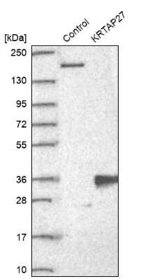 Western Blot: KRTAP27-1 Antibody [NBP2-33539]