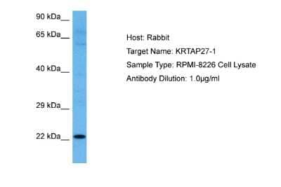 Western Blot: KRTAP27-1 Antibody [NBP2-85178]