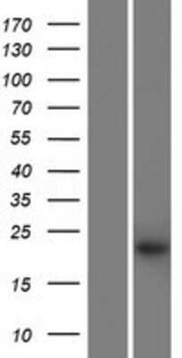 Western Blot: KRTAP27-1 Overexpression Lysate [NBP2-10640]