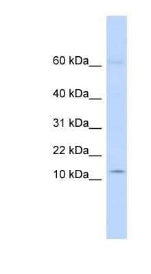 Western Blot: KRTAP8-1 Antibody [NBP1-91596]