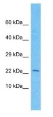 Western Blot: KRTAP9-2 Antibody [NBP3-09397]