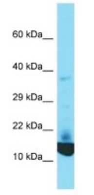 Western Blot: KRTCAP2 Antibody [NBP3-09743]