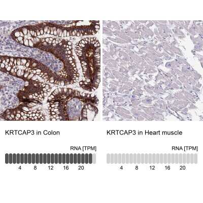 Immunohistochemistry-Paraffin: KRTCAP3 Antibody [NBP2-14179]