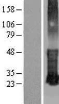 Western Blot: KRTCAP3 Overexpression Lysate [NBL1-12412]