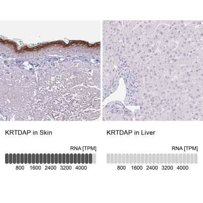 Immunohistochemistry-Paraffin: KRTDAP Antibody [NBP2-38029]