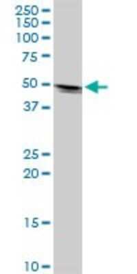 Western Blot: KRTHA2 Antibody [H00003882-B01P]