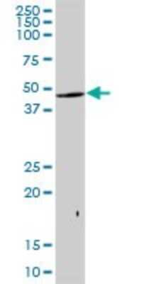 Western Blot: KRTHA2 Antibody [H00003882-B01P]