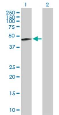 Western Blot: KRTHA2 Antibody [H00003882-B01P]