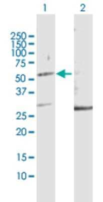 Western Blot: KRTHA2 Antibody [H00003882-D01P]