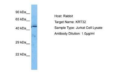 Western Blot: KRTHA2 Antibody [NBP2-86696]