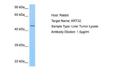 Western Blot: KRTHA2 Antibody [NBP2-86697]