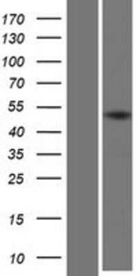 Western Blot: KRTHA2 Overexpression Lysate [NBP2-11064]