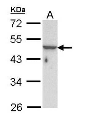 Western Blot: KRTHA3B Antibody [NBP1-31709]