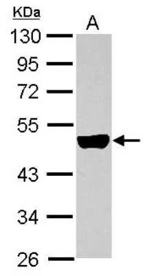 Western Blot: KRTHA3B Antibody [NBP2-19310]