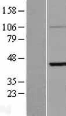 Western Blot: KRTHA3B Overexpression Lysate [NBP2-11065]