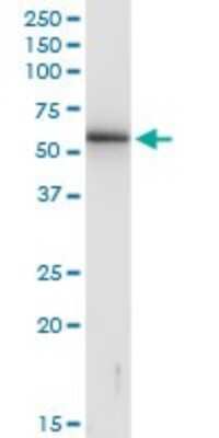 Western Blot: KRTHB3 Antibody [H00003889-B01P]