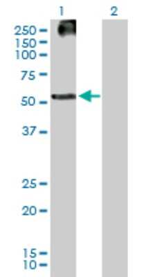 Western Blot: KRTHB3 Antibody [H00003889-B01P]