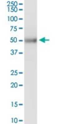 Western Blot: KRTHB3 Antibody [H00003889-D01P]