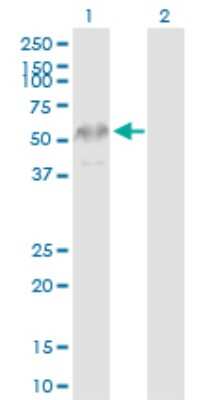 Western Blot: KRTHB3 Antibody [H00003889-D01P]