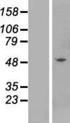 Western Blot: KRTHB3 Overexpression Lysate [NBP2-10817]