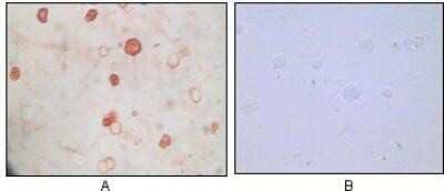 Immunohistochemistry-Paraffin: KSHV K8 Antibody (8C12G10G1) - BSA Free [NB100-2189]