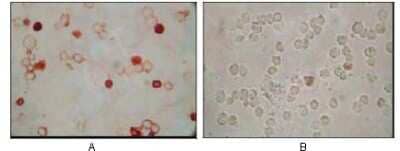 Immunohistochemistry: KSHV ORF62 Antibody (5B7B6) - BSA Free [NBP2-37684]