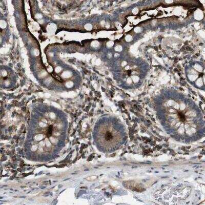 Immunohistochemistry-Paraffin: KSR1 Antibody [NBP1-82863]