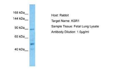 Western Blot: KSR1 Antibody [NBP2-85179]