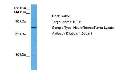 Western Blot: KSR1 Antibody [NBP2-85180]