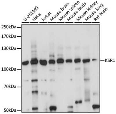 Western Blot: KSR1 AntibodyAzide and BSA Free [NBP3-04958]