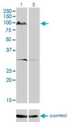 Western Blot: KSR2 Antibody (1G4) [H00283455-M08]