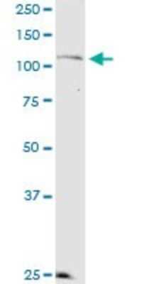 Western Blot: KSR2 Antibody (1G4) [H00283455-M08]