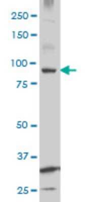 Western Blot: KSR2 Antibody (3F11) [H00283455-M07]