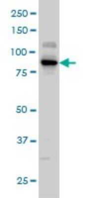 Western Blot: KSR2 Antibody (5C4) [H00283455-M05]