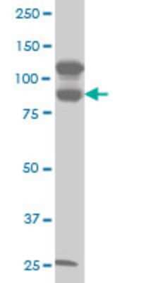 Western Blot: KSR2 Antibody (5E9) [H00283455-M06]