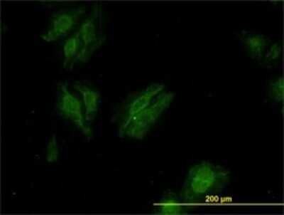 Immunocytochemistry/ Immunofluorescence: KSR2 Antibody (6C9) [H00283455-M02]