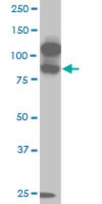 Western Blot: KSR2 Antibody (6C9) [H00283455-M02]