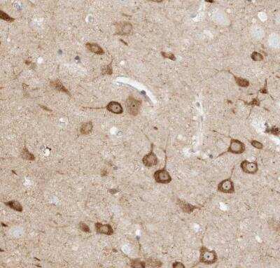 Immunohistochemistry-Paraffin: KSR2 Antibody [NBP1-83553]