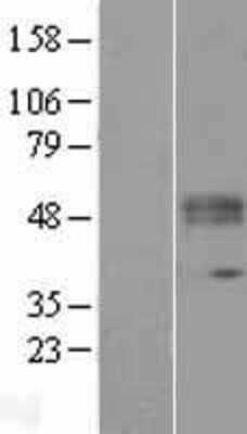 Western Blot: Protein O-Glucosyltransferase 1/POGLUT1/KTELC1 Overexpression Lysate [NBL1-12414]