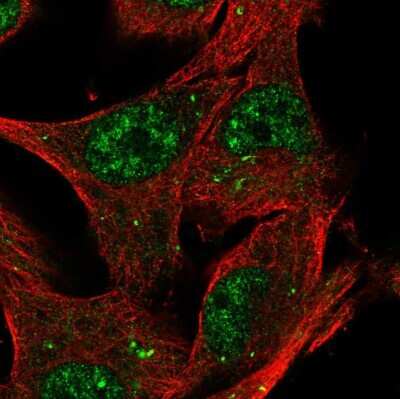 Immunocytochemistry/ Immunofluorescence: KTI12 Antibody [NBP2-68622]