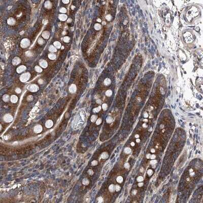 Immunohistochemistry-Paraffin: KTI12 Antibody [NBP1-81176]
