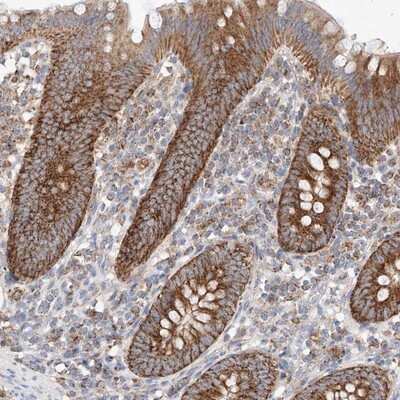Immunohistochemistry-Paraffin: KTI12 Antibody [NBP1-81177]