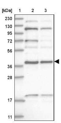 Western Blot: KTI12 Antibody [NBP1-81176]