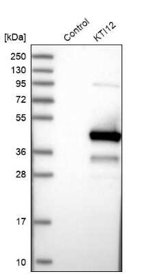 Western Blot: KTI12 Antibody [NBP1-81177]