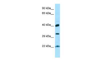 Western Blot: KTI12 Antibody [NBP2-87703]