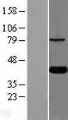 Western Blot: KTI12 Overexpression Lysate [NBL1-12415]