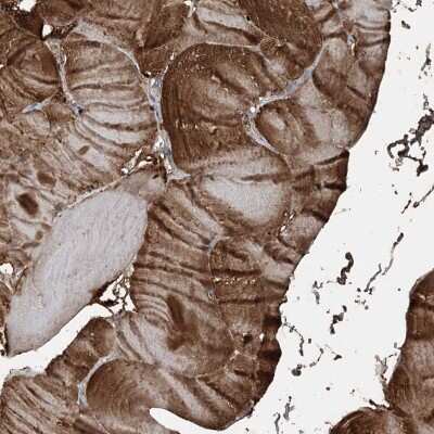 Immunohistochemistry-Paraffin: KY Antibody [NBP2-48660]